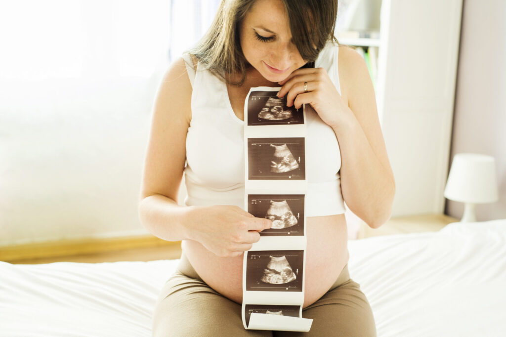 Beautiful pregnant woman holding ultrasound scan picture